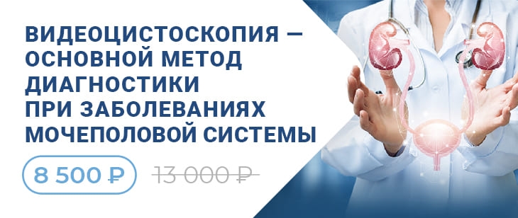 Видеоцистоскопия